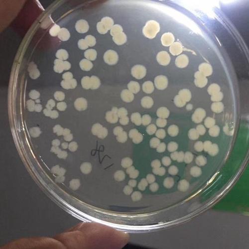 微生物肥料添加解淀粉芽孢杆菌厂家